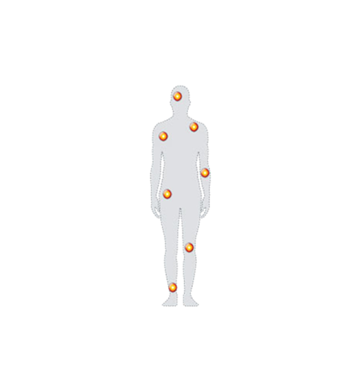 Graphical Representation of a Human Body Showing the Common Pain Points